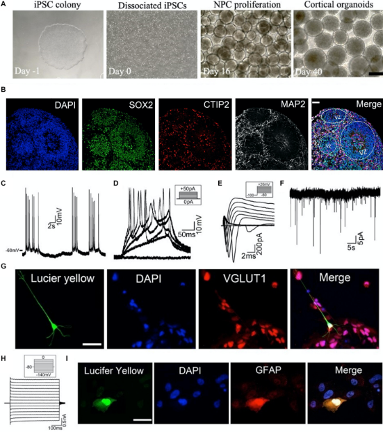 maturation and circuit integration of transplanted human cortical organoids 